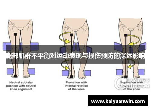 腿部肌群不平衡对运动表现与损伤预防的深远影响
